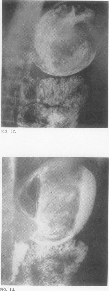 FIG. 1c-1d