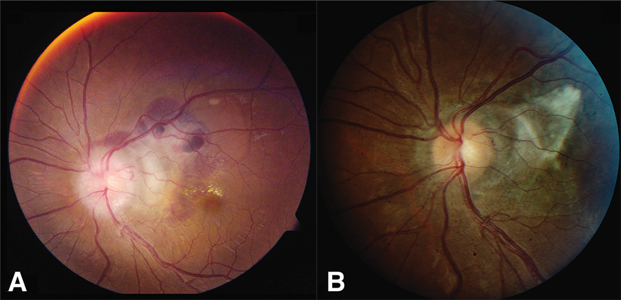 Figure 3.