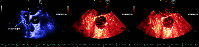 Fig. 2