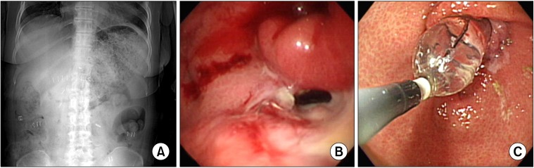 Fig. 1