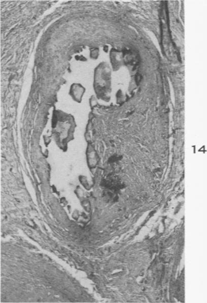 Fig. 14