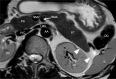 Fig. 11