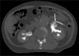 Fig. 12