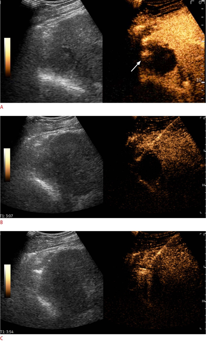 Fig. 10.