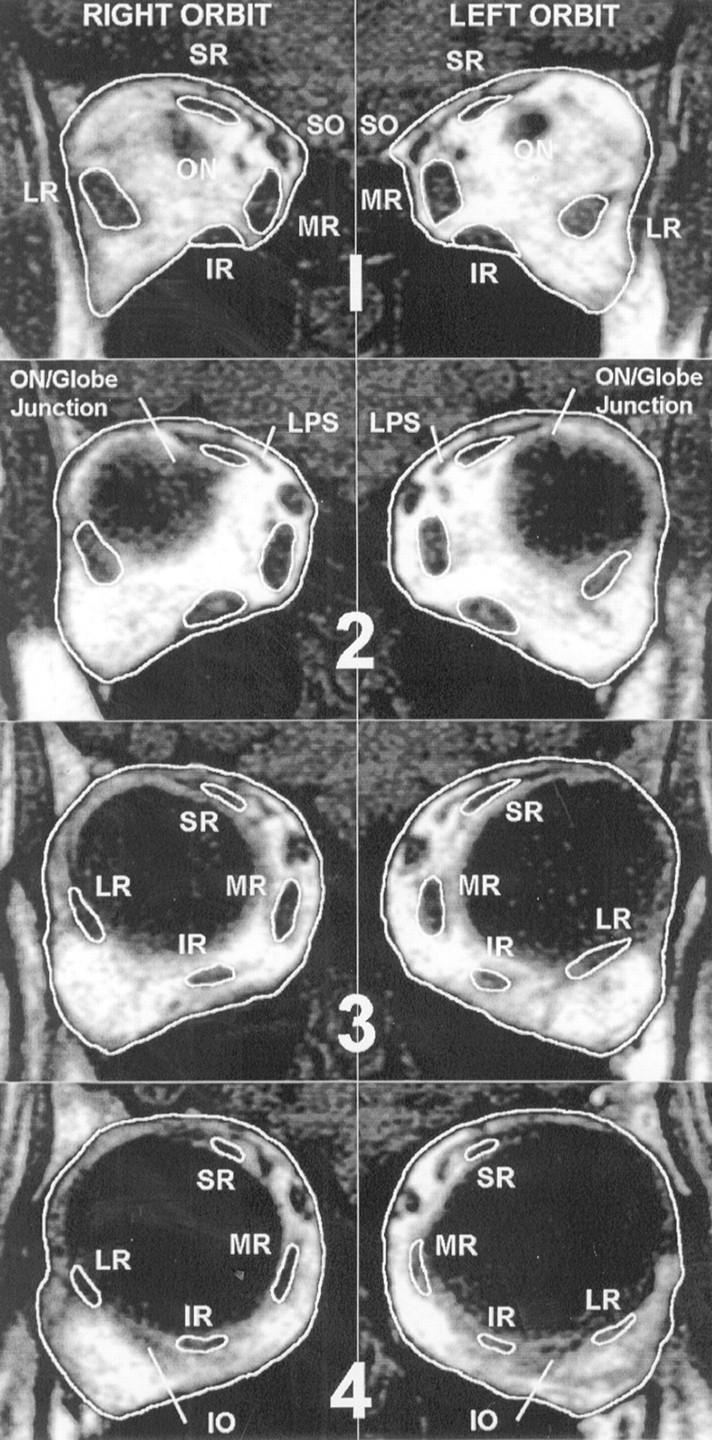 Figure 1  