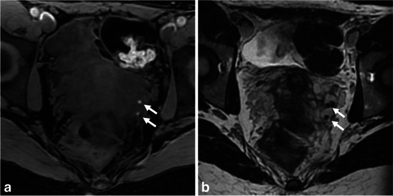 Fig. 11