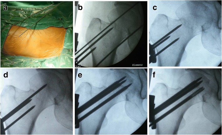 Fig. 2