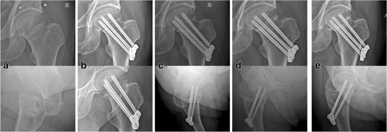 Fig. 4