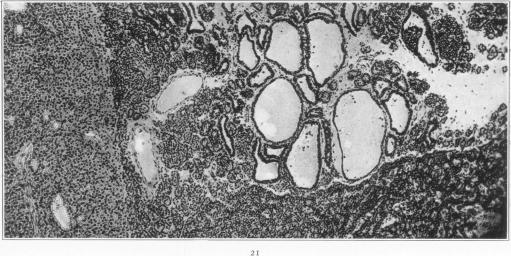 Fig. 21