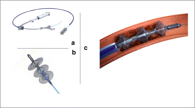 Fig. 2