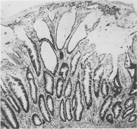 FIG. 11