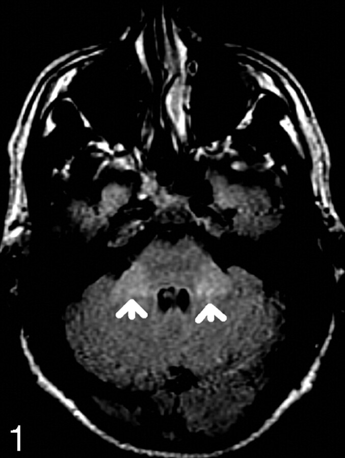 Fig 1.