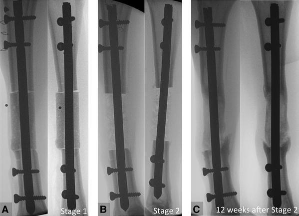 Fig. 4A–C