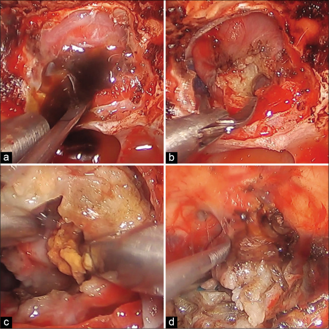 Figure 3: