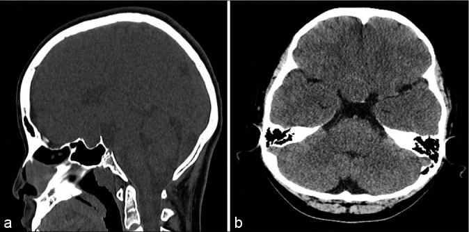 Figure 2: