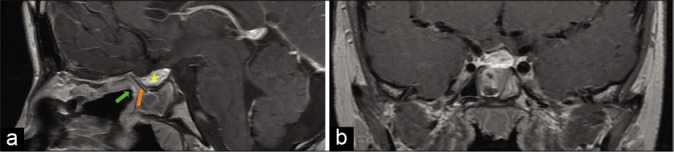 Figure 4: