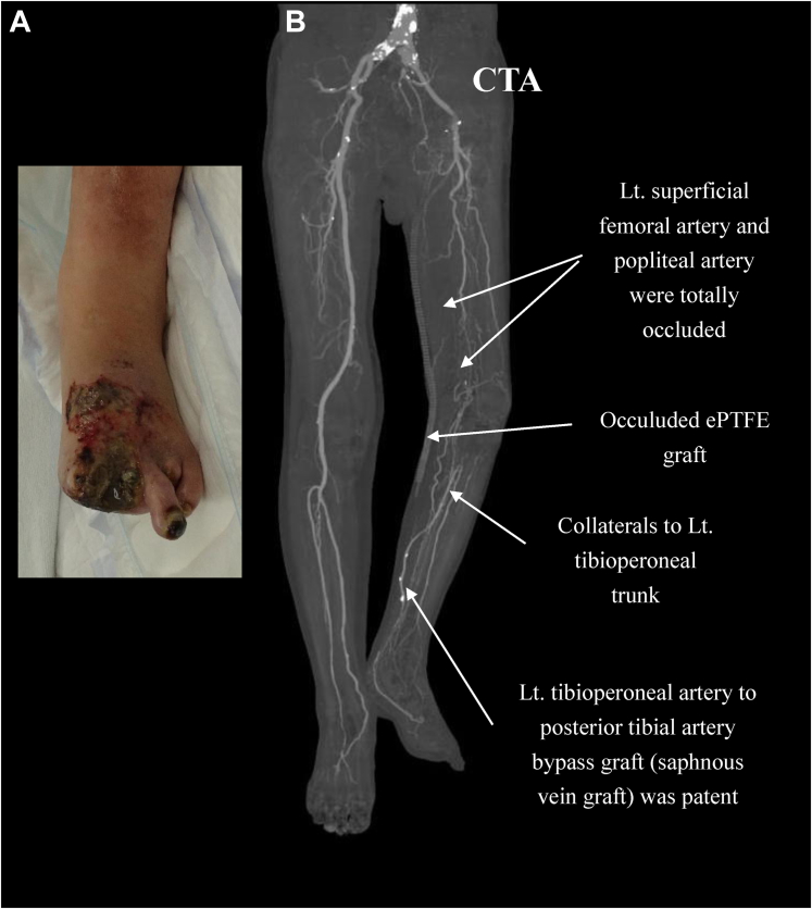 Fig 1