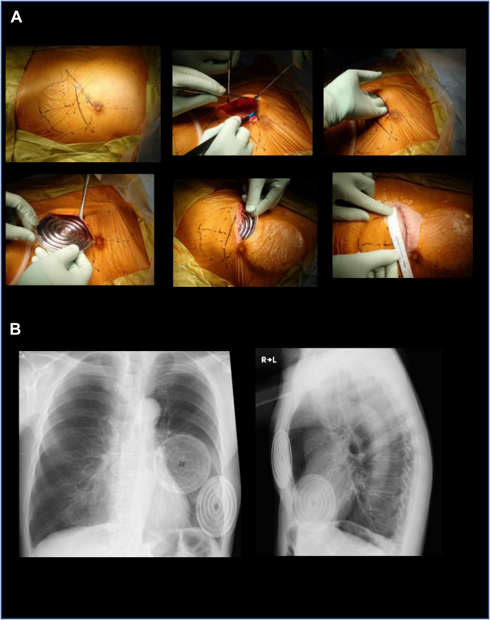 Fig 2