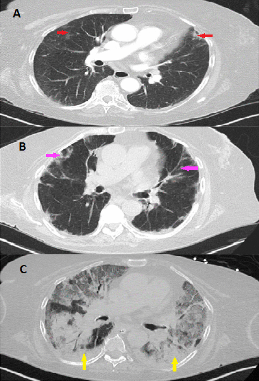 Fig. 3