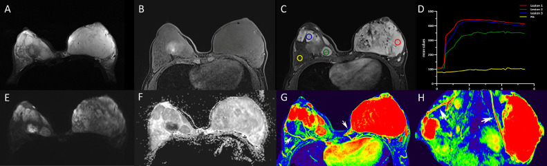 Fig 2