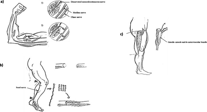 Fig. 1