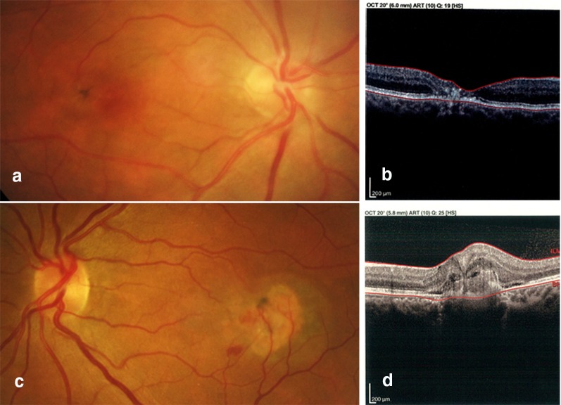 Fig. 1