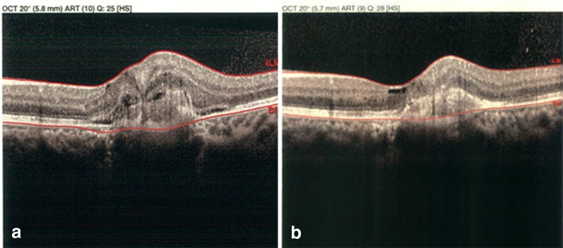 Fig. 2