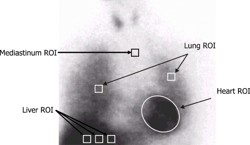 Fig. 1