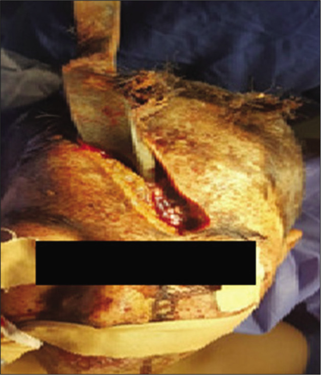 Figure 1: