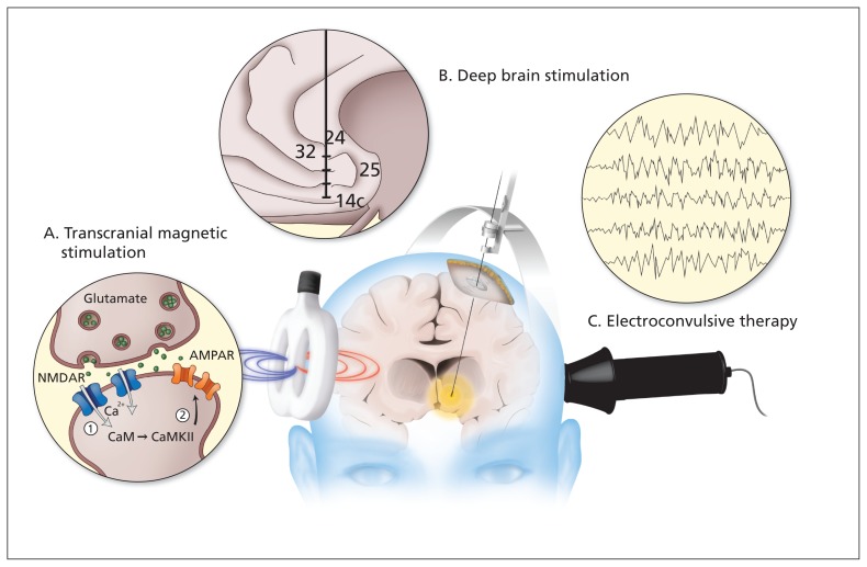 Figure 1: