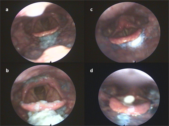 Fig. 3