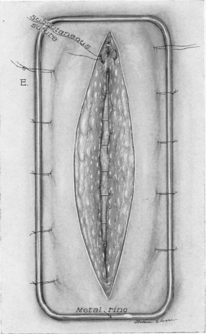 Fig. 17.