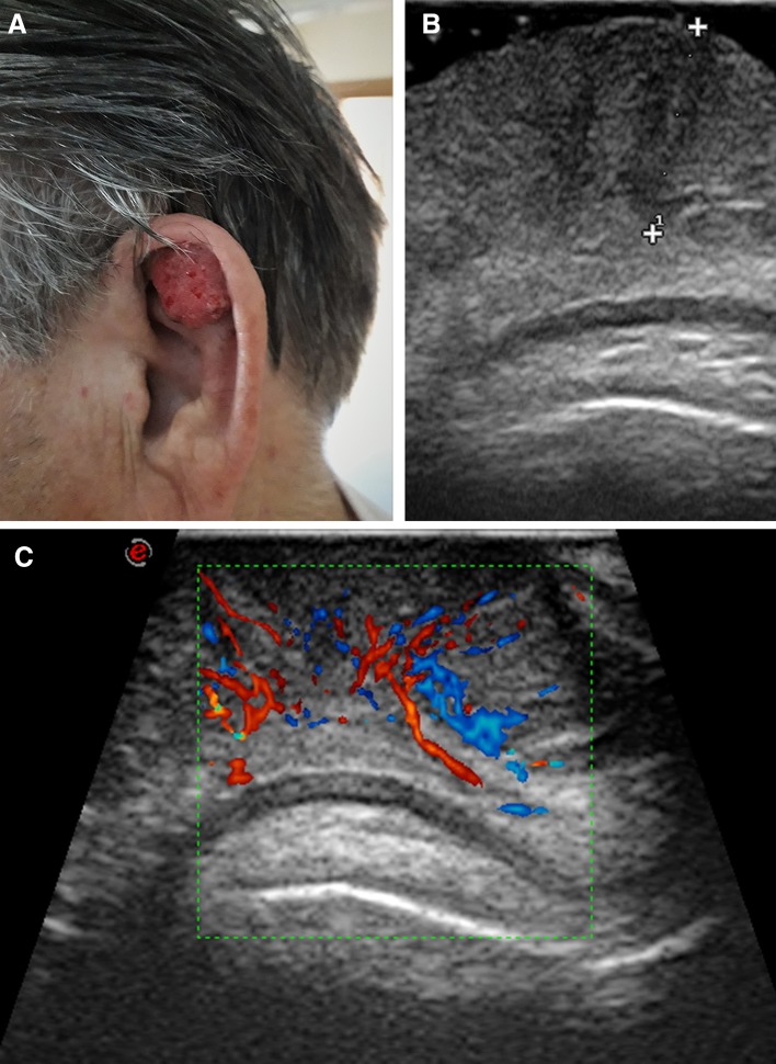 Fig. 4