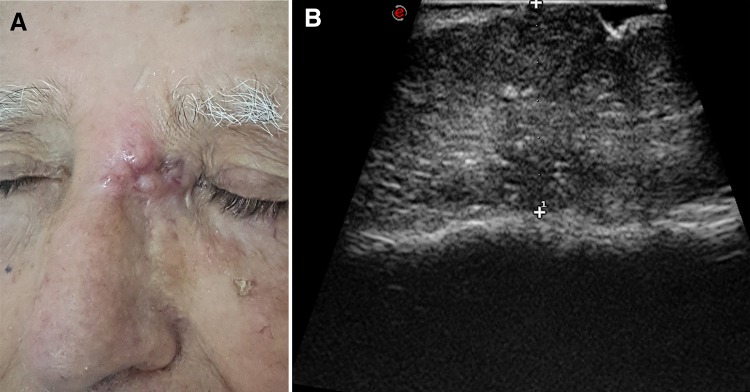 Fig. 2