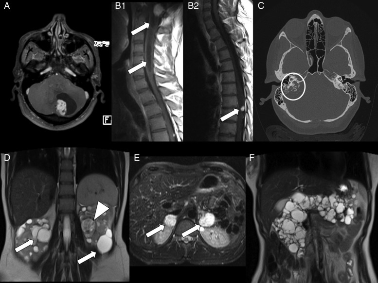 Fig. 1