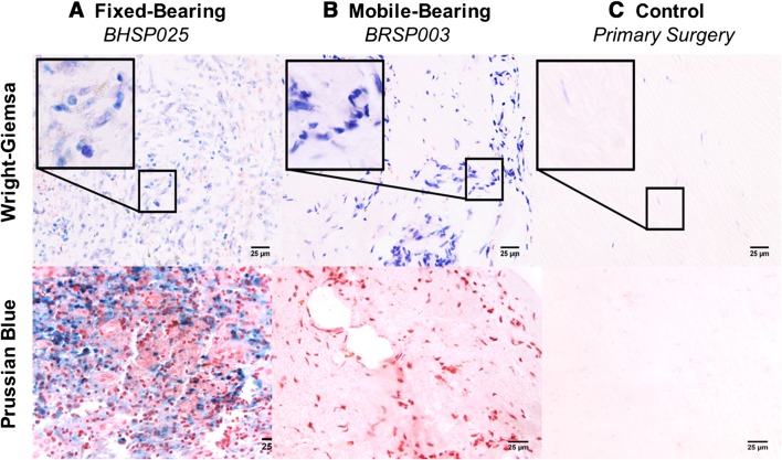 Fig. 2A–C