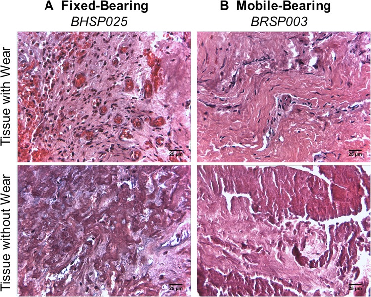 Fig. 3A–B