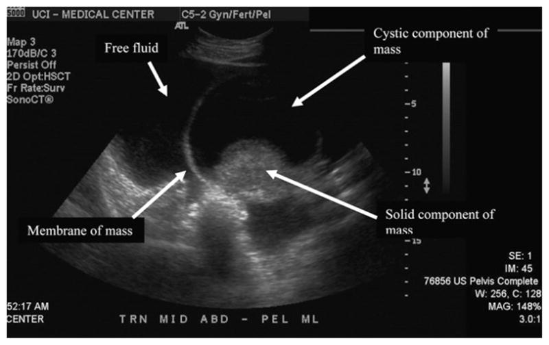 Fig 2