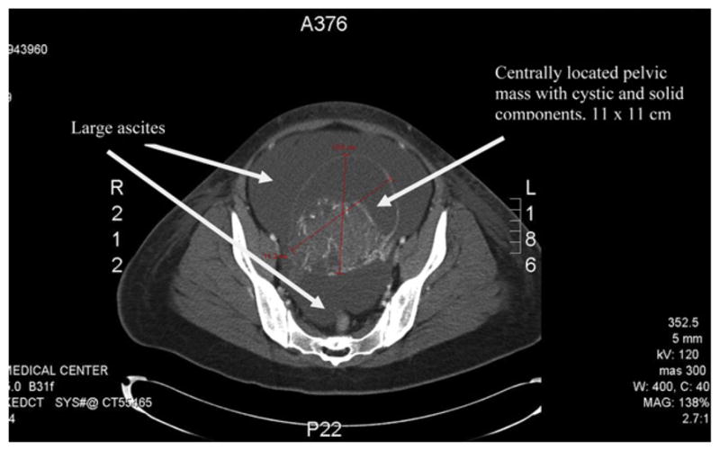 Fig 1