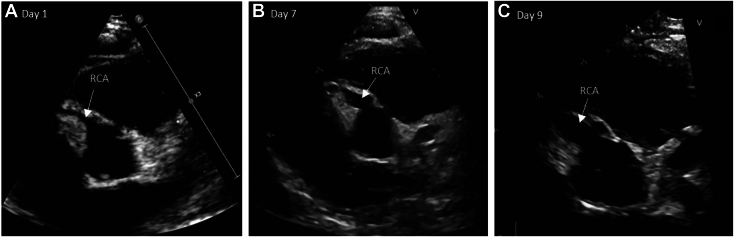 Figure 2