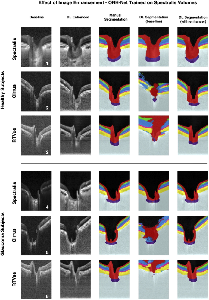 Fig. 4.