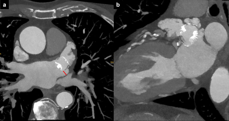 Figure 11.