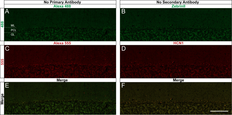 Figure 2—figure supplement 2.