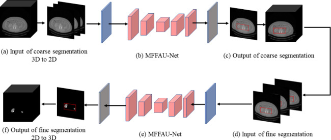 2.5D MFFAU-Net: a convolutional neural network for kidney segmentation ...