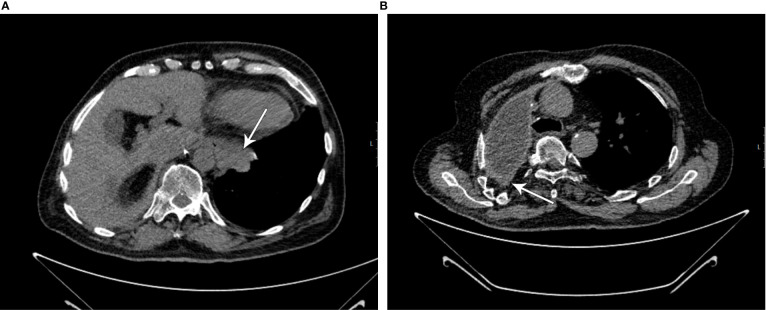 Figure 1