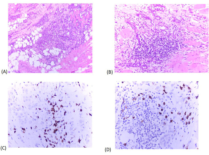 Figure 4