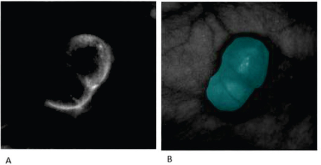 Fig. 10