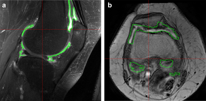 Fig. 1