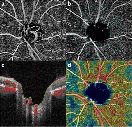 Fig. 3