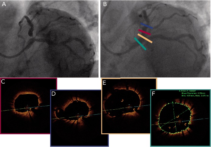 Figure 3: